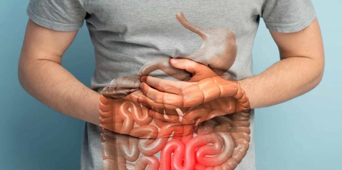 ¿Qué significa un diagnóstico de enfermedad inflamatoria intestinal?