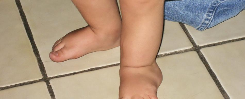 Someten a un niño a una cirugía pionera