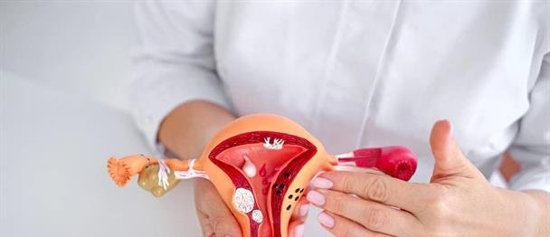 Endometriosis y síndrome de ovario poliquístico